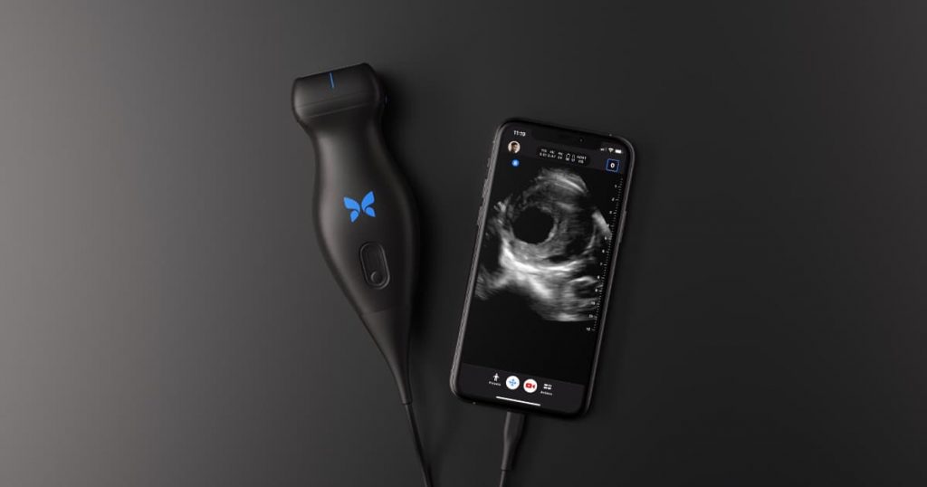 The Butterfly IQ ultrasound